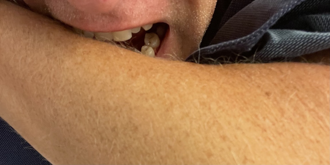 Nödsituation bita ordningsvakt som greppade halsen  